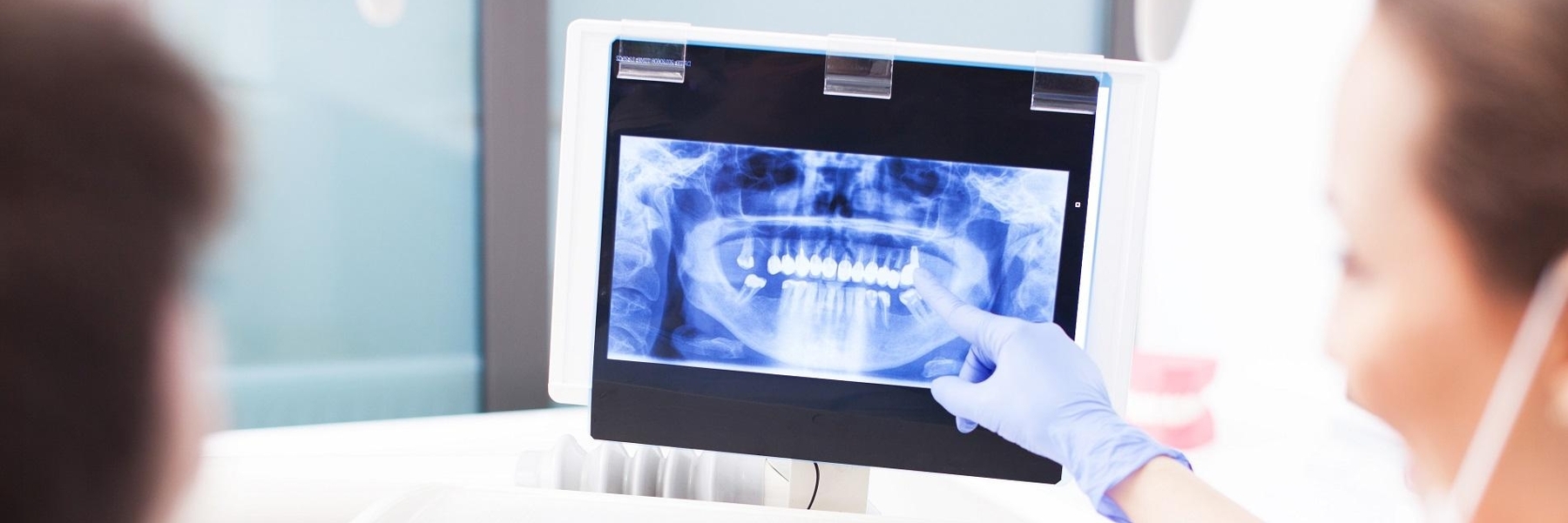 Digital Dental X-Rays | Dentist